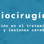 Radiocirugía: Innovación en el tratamiento de tumores y lesiones cerebrales