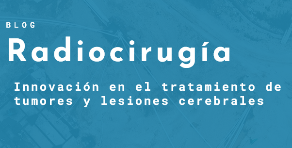 Radiocirugía: Innovación en el tratamiento de tumores y lesiones cerebrales