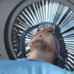 Neuro-oncología: Avances y Desafíos en el Tratamiento de Tumores Cerebrales