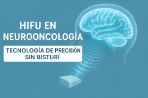 Ilustración digital de cerebro humano recibiendo tratamiento HIFU, tecnología médica sin bisturí aplicada en neurooncología