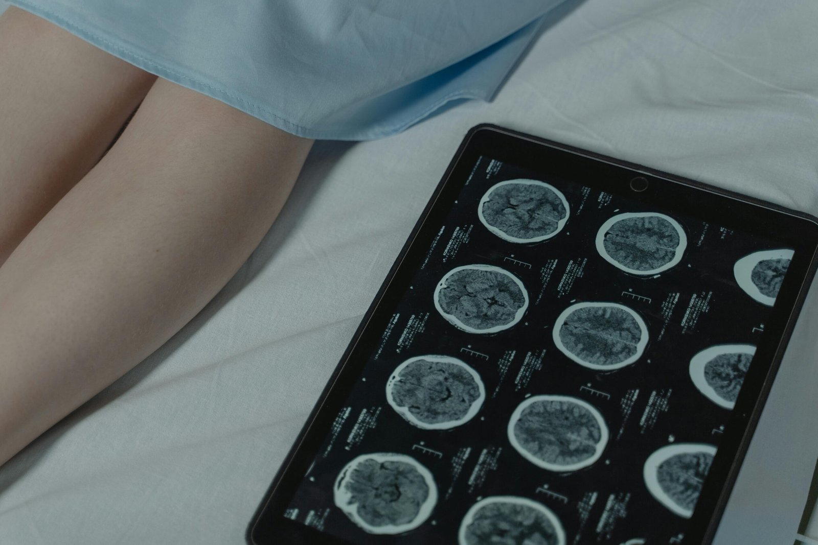 Close-up of brain CT scan display on tablet beside patient's legs in a hospital room.