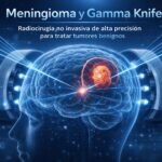 Meningiomas Intracraneales: Guía Experta sobre Tratamiento sin Cirugía Abierta con Gamma Knife