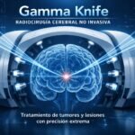 ​¿Qué es Gamma Knife? La Tecnología que Opera el Cerebro Sin Bisturí