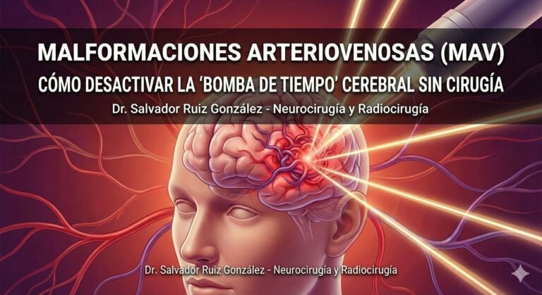 Malformaciones Arteriovenosas (MAV): Cómo Desactivar la “Bomba de Tiempo” Cerebral sin Cirugía