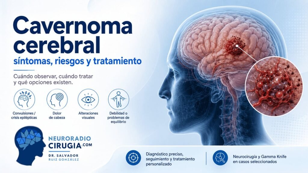 Imagen médica sobre cavernoma cerebral con ilustración del cerebro, lesión vascular tipo cavernoma y síntomas como convulsiones, dolor de cabeza, alteraciones visuales y problemas de equilibrio.