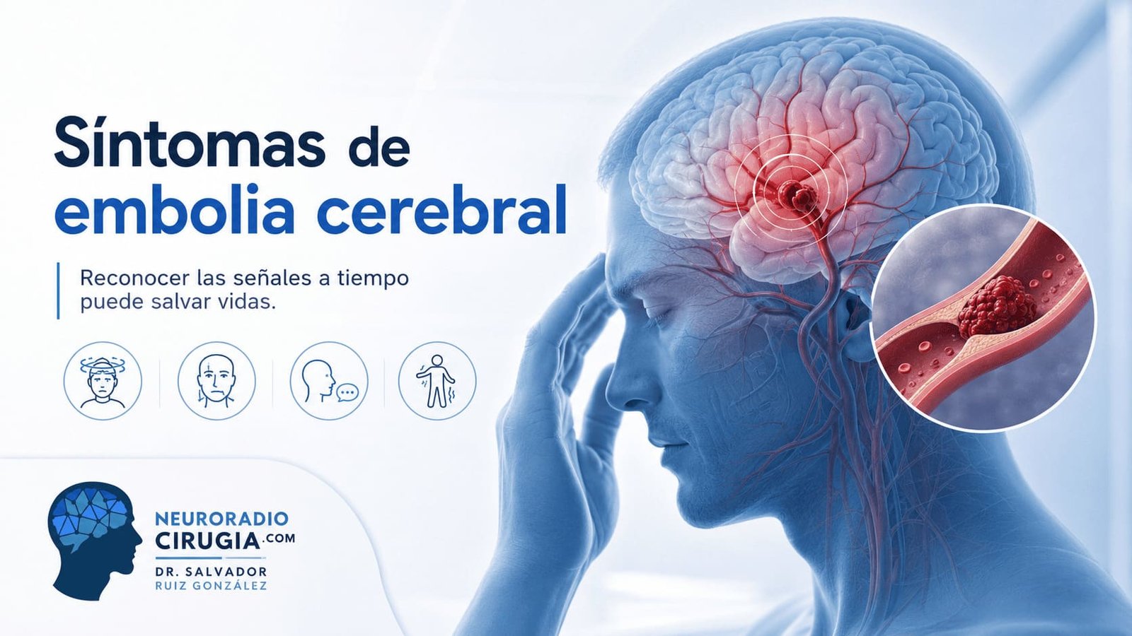 Imagen médica sobre los síntomas de embolia cerebral, con representación del cerebro, obstrucción vascular y señales de alerta neurológica.