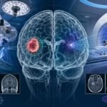Tumor cerebral operable o no operable y Gamma Knife para tumor cerebral